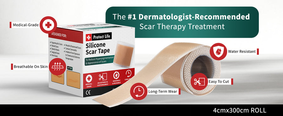 Medical-Grade Silicone Scar Tape Roll 3M